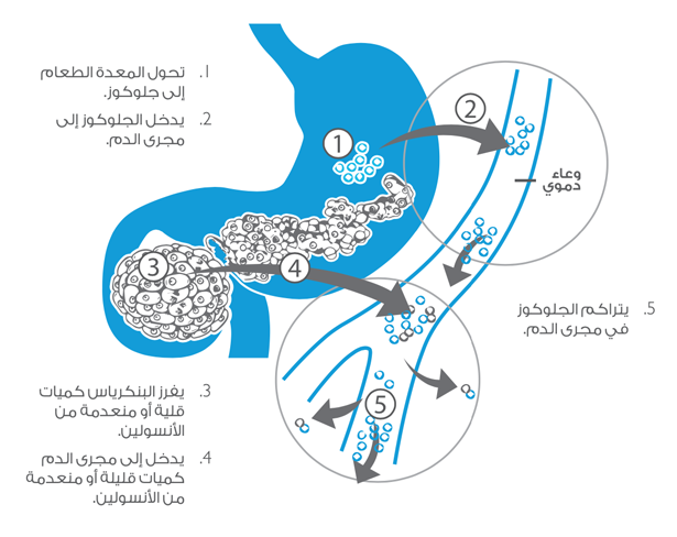 what is insulin 