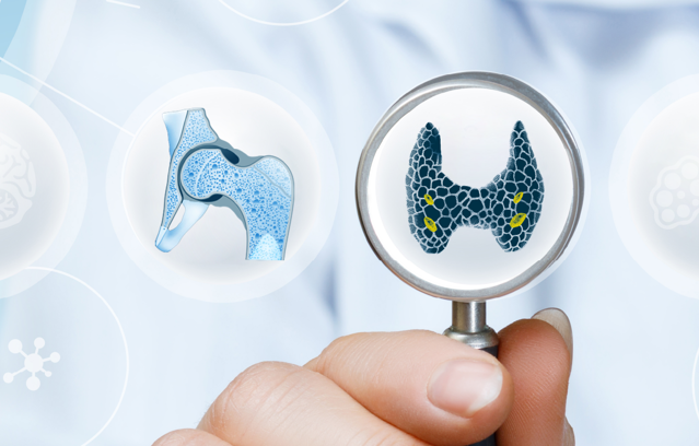 Bone And Calcium Homepage Banner V2