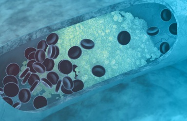 Lipid Masterclass Homepage