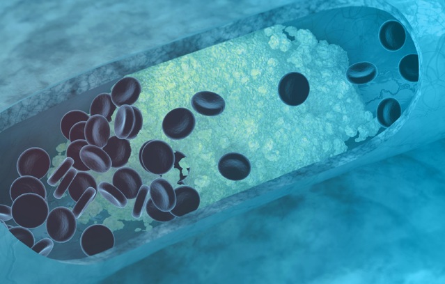 Lipid Masterclass Homepage